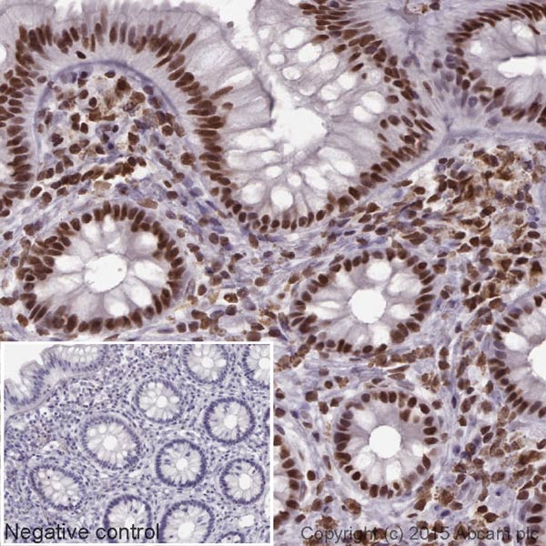 Immunohistochemistry (Formalin/PFA-fixed paraffin-embedded sections) - Donkey Anti-Mouse IgG H&L (HRP) (AB205724), expandable thumbnail