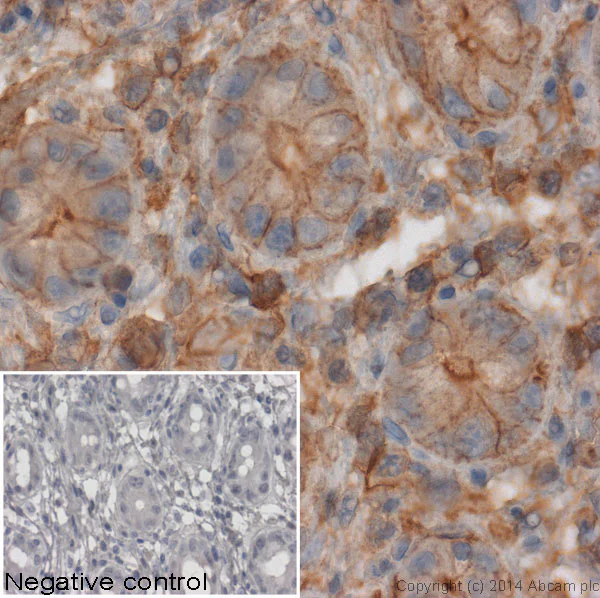 Immunohistochemistry (Formalin/PFA-fixed paraffin-embedded sections) - Donkey Anti-Mouse IgG H&L (HRP) (AB6820)
