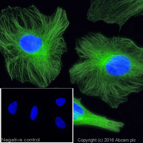 Donkey anti-rabbit IgG Alexa Fluor® 488 secondary antibody