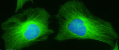 Immunocytochemistry/ Immunofluorescence - Donkey Anti-Rabbit IgG H&L (Alexa Fluor® 488) preadsorbed (AB150061), expandable thumbnail