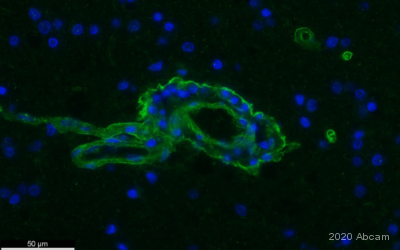 Immunohistochemistry (Formalin/PFA-fixed paraffin-embedded sections) - Donkey Anti-Rabbit IgG H&L (Alexa Fluor® 488) preadsorbed (AB150065), expandable thumbnail
