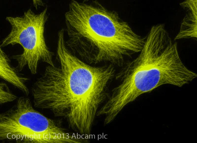 Donkey Anti-Rabbit IgG (Alexa Fluor® 555) preadsorbed secondary