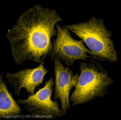 Donkey Anti Rabbit (IgG) secondary antibody preadsorbed