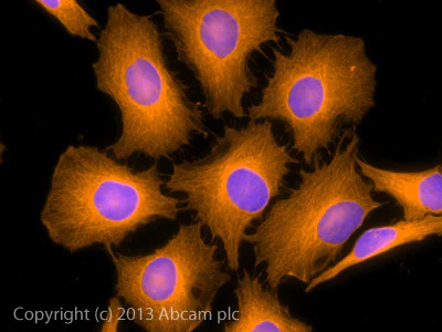 Immunocytochemistry/ Immunofluorescence - Donkey Anti-Rabbit IgG H&L (Alexa Fluor® 594) preadsorbed (AB150064)