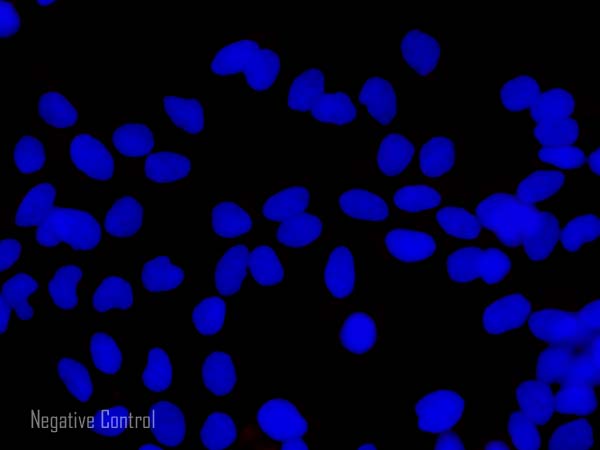 Donkey Anti Rabbit (IgG) secondary antibody preadsorbed