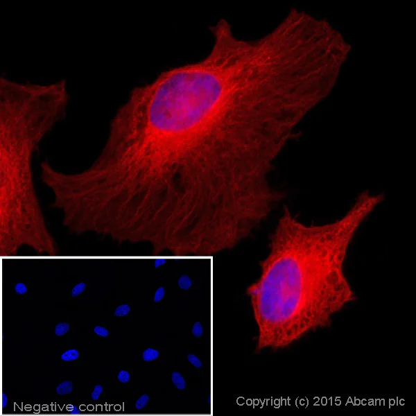 Donkey anti-rabbit IgG Alexa Fluor® 647 secondary antibody