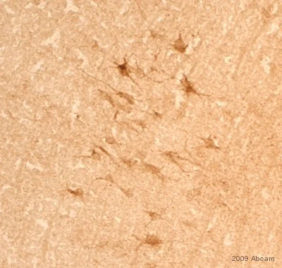 Immunohistochemistry (Formalin/PFA-fixed paraffin-embedded sections) - Donkey Anti-Rabbit IgG H&L (Biotin) (AB6801)