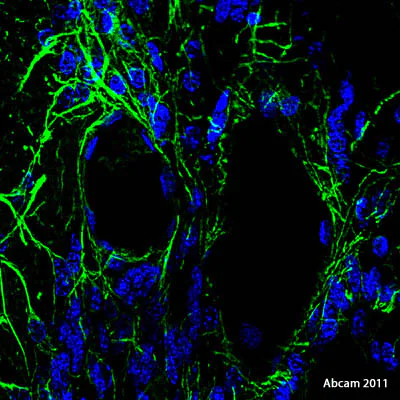 Immunohistochemistry (Formalin/PFA-fixed paraffin-embedded sections) - Donkey Anti-Rabbit IgG H&L (DyLight® 488) preadsorbed (AB96919)
