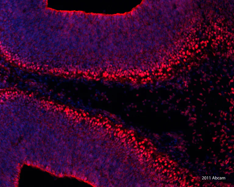 Immunohistochemistry (Frozen sections) - Donkey Anti-Rabbit IgG H&L (DyLight® 594) preadsorbed (AB96921)