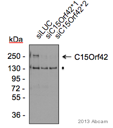 Donkey Anti Rabbit (IgG) secondary antibody HRP (ab16284) | Abcam