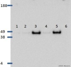 Donkey Anti Rabbit (IgG) secondary antibody HRP (ab16284) | Abcam