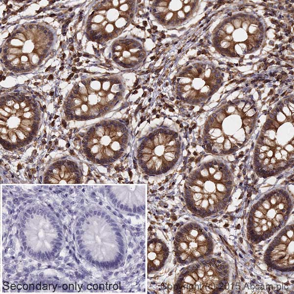 Immunohistochemistry (Formalin/PFA-fixed paraffin-embedded sections) - Donkey Anti-Rabbit IgG H&L (HRP) (AB205722), expandable thumbnail
