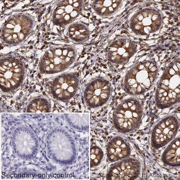 Immunohistochemistry (Formalin/PFA-fixed paraffin-embedded sections) - Donkey Anti-Rabbit IgG H&L (HRP) (AB205722)