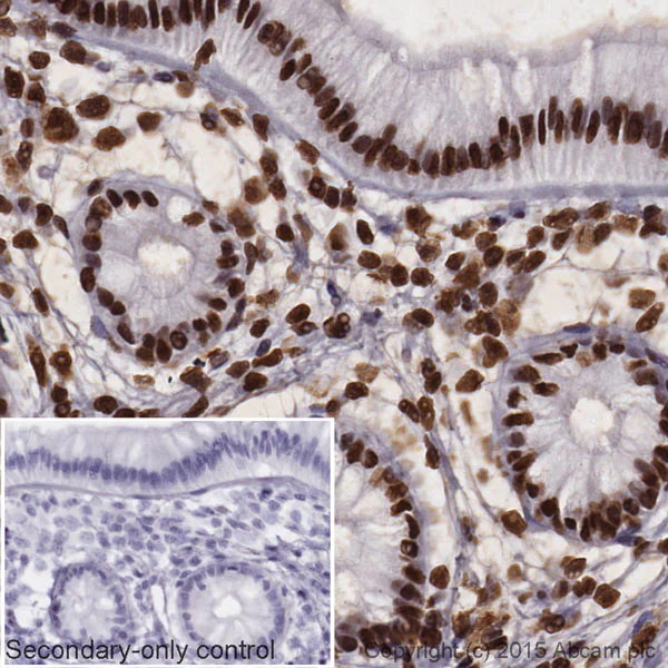 Immunohistochemistry (Formalin/PFA-fixed paraffin-embedded sections) - Donkey Anti-Rabbit IgG H&L (HRP) (AB205722)