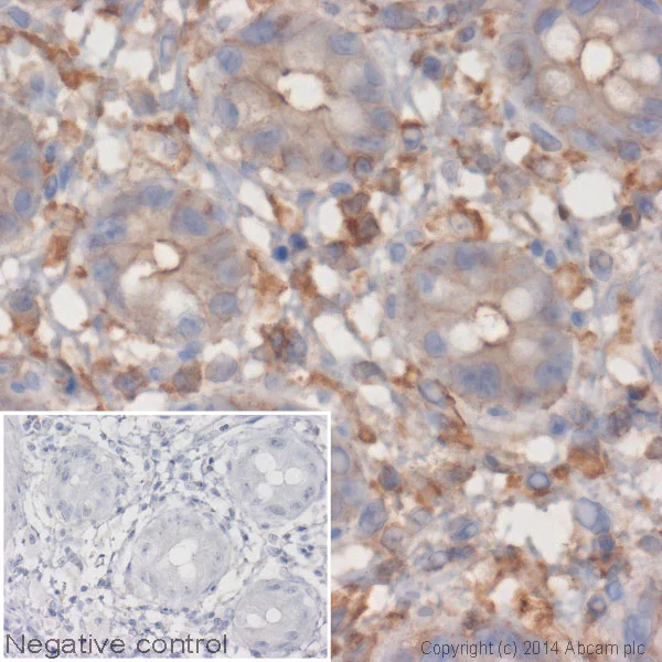 Immunohistochemistry (Formalin/PFA-fixed paraffin-embedded sections) - Donkey Anti-Rabbit IgG H&L (HRP) (AB6802)