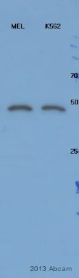 Western blot - Donkey Anti-Rabbit IgG H&L (HRP) (AB6802)