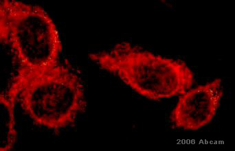 Donkey Anti-Rabbit IgG H&L (TRITC) preadsorbed