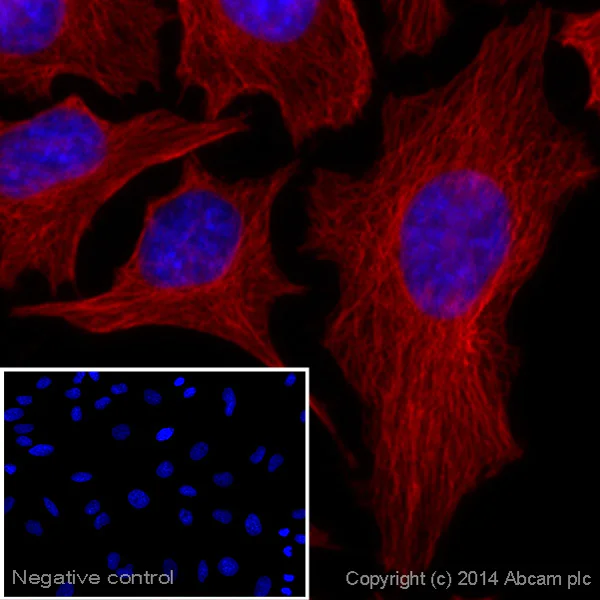 Immunocytochemistry/ Immunofluorescence - Donkey Anti-Rat IgG H&L (Alexa Fluor® 647) preadsorbed (AB150155)