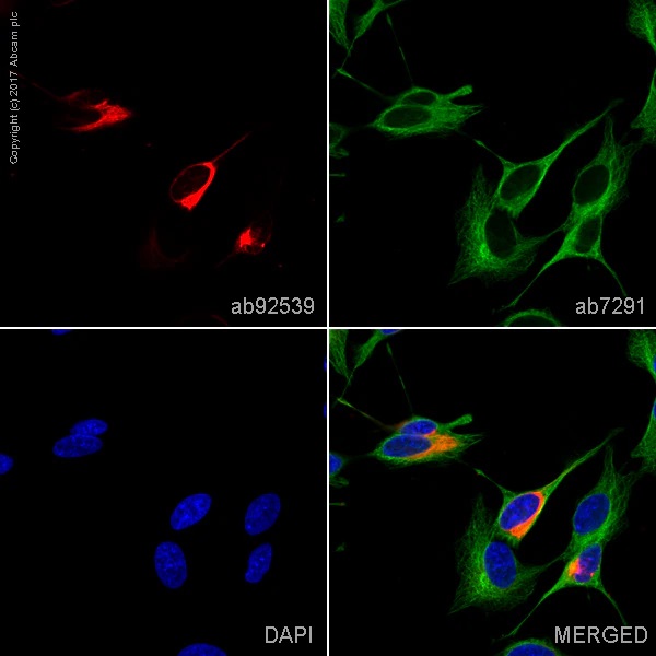 Immunocytochemistry/ Immunofluorescence - Donkey Anti-Sheep IgG H&L (Alexa Fluor® 488) (AB150177), expandable thumbnail