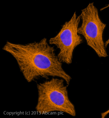 Immunocytochemistry/ Immunofluorescence - Donkey Anti-Sheep IgG H&L (Alexa Fluor® 594) (AB150180), expandable thumbnail