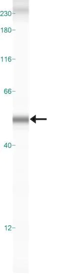 Western blot - Anti-DOPA Decarboxylase/DDC antibody (AB3905)