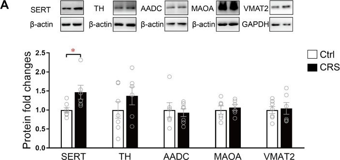 Western blot - Anti-DOPA Decarboxylase/DDC antibody (AB3905)