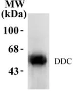 Western blot - Anti-DOPA Decarboxylase/DDC antibody (AB3905)