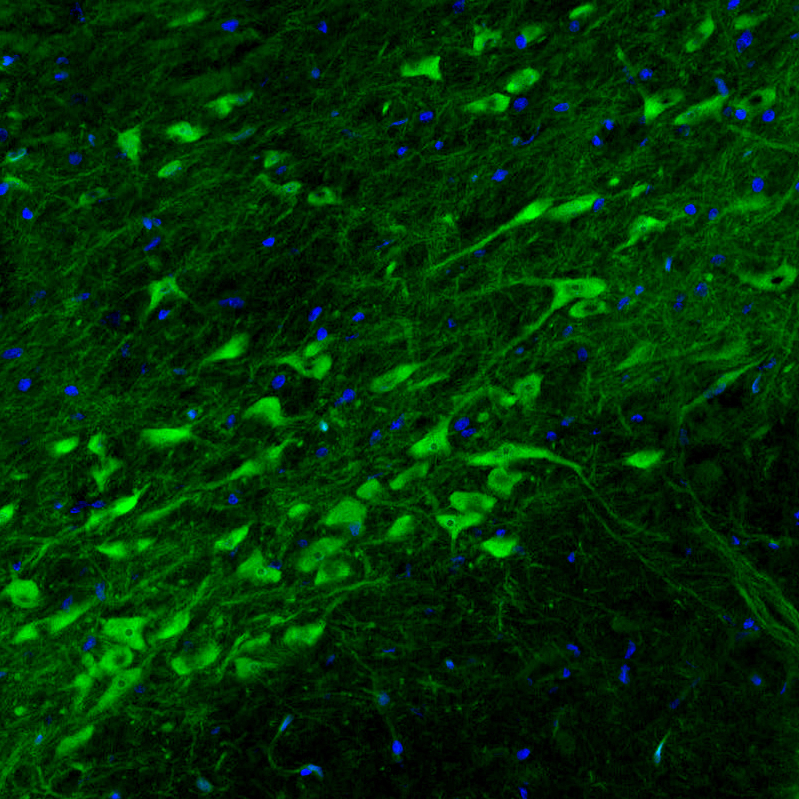Immunocytochemistry/ Immunofluorescence - Anti-DOPA Decarboxylase/DDC antibody [CL2962] (AB211535), expandable thumbnail
