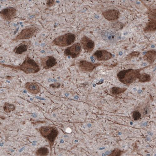 Immunohistochemistry (Formalin/PFA-fixed paraffin-embedded sections) - Anti-DOPA Decarboxylase/DDC antibody [CL2962] (AB211535), expandable thumbnail