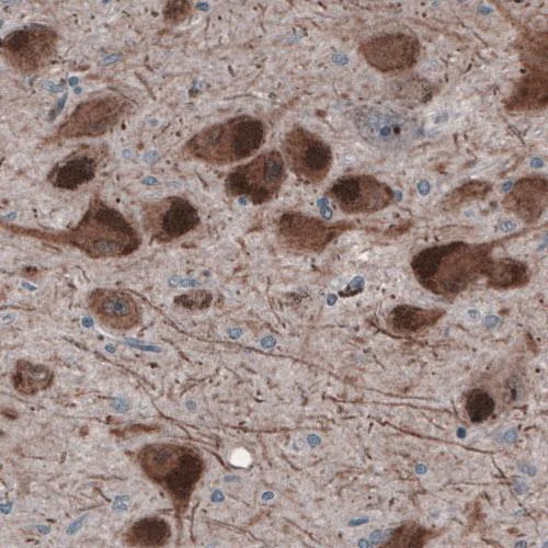 Immunohistochemistry (Formalin/PFA-fixed paraffin-embedded sections) - Anti-DOPA Decarboxylase/DDC antibody [CL2962] (AB211535)