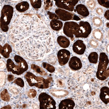 Immunohistochemistry (Formalin/PFA-fixed paraffin-embedded sections) - Anti-DOPA Decarboxylase/DDC antibody [CL2962] (AB211535), expandable thumbnail