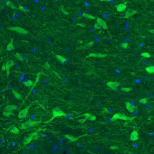 Immunohistochemistry (Formalin/PFA-fixed paraffin-embedded sections) - Anti-DOPA Decarboxylase/DDC antibody [CL2962] (ab211535), expandable thumbnail