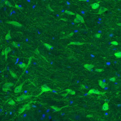 Immunohistochemistry (Formalin/PFA-fixed paraffin-embedded sections) - Anti-DOPA Decarboxylase/DDC antibody [CL2962] (AB211535)