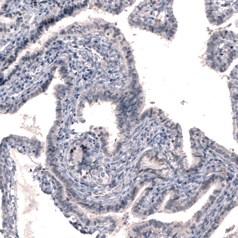 Immunohistochemistry (Formalin/PFA-fixed paraffin-embedded sections) - Anti-DOPA Decarboxylase/DDC antibody [CL2962] (AB211535), expandable thumbnail