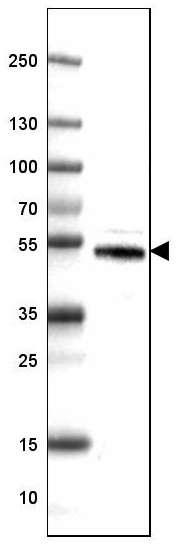 Western blot - Anti-DOPA Decarboxylase/DDC antibody [CL2962] (AB211535), expandable thumbnail