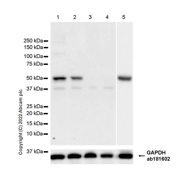 Western blot - Anti-DOPA Decarboxylase/DDC antibody [EPR24026-205] (AB307813)