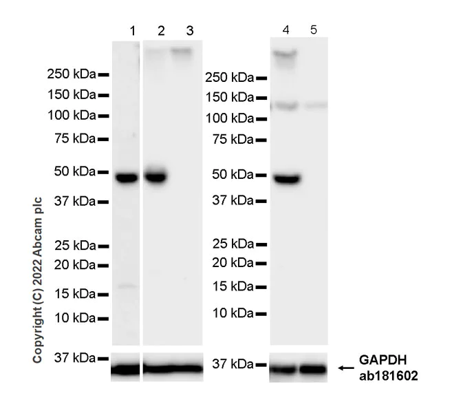 Western blot - Anti-DOPA Decarboxylase/DDC antibody [EPR24026-205] (AB307813)
