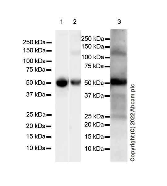 Western blot - Anti-DOPA Decarboxylase/DDC antibody [EPR24026-205] (AB307813)