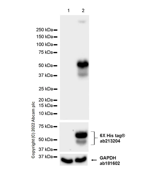 Western blot - Anti-DOPA Decarboxylase/DDC antibody [EPR24026-205] (AB307813)