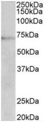 Western blot - Anti-Dopamine beta Hydroxylase antibody (AB189991)