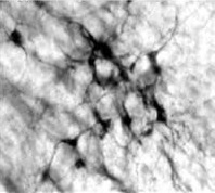 Immunohistochemistry (Formalin/PFA-fixed paraffin-embedded sections) - Anti-Dopamine beta Hydroxylase antibody (AB19353)