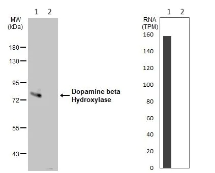Western blot - Anti-Dopamine beta Hydroxylase antibody (AB96615)