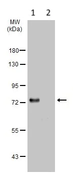 Western blot - Anti-Dopamine beta Hydroxylase antibody (AB96615)