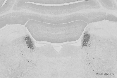 Immunohistochemistry (Formalin/PFA-fixed paraffin-embedded sections) - Anti-Dopamine beta Hydroxylase antibody [EPR20385] (ab209487), expandable thumbnail