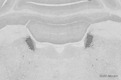 Immunohistochemistry (Formalin/PFA-fixed paraffin-embedded sections) - Anti-Dopamine beta Hydroxylase antibody [EPR20385] (AB209487)