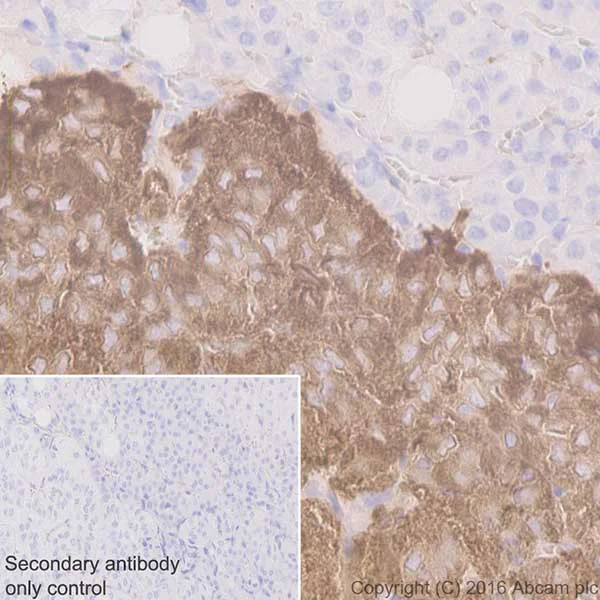 Immunohistochemistry (Formalin/PFA-fixed paraffin-embedded sections) - Anti-Dopamine beta Hydroxylase antibody [EPR20385] (AB209487)