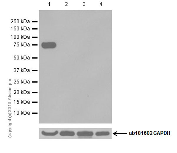 Western blot - Anti-Dopamine beta Hydroxylase antibody [EPR20385] (AB209487), expandable thumbnail