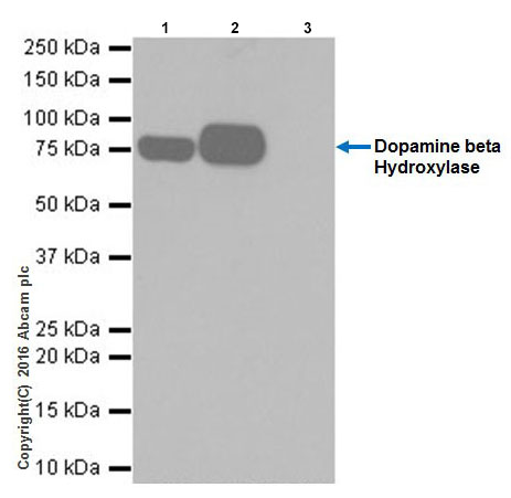 Immunoprecipitation - Anti-Dopamine beta Hydroxylase antibody [EPR20385] - BSA and Azide free (AB223130), expandable thumbnail