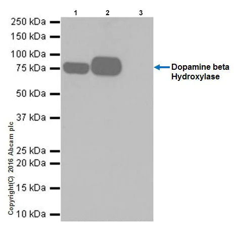Immunoprecipitation - Anti-Dopamine beta Hydroxylase antibody [EPR20385] - BSA and Azide free (AB223130)