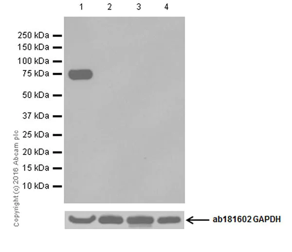 Western blot - Anti-Dopamine beta Hydroxylase antibody [EPR20385] - BSA and Azide free (AB223130)